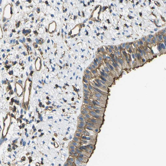 GRRP1 Antibody in Immunohistochemistry (Paraffin) (IHC (P))
