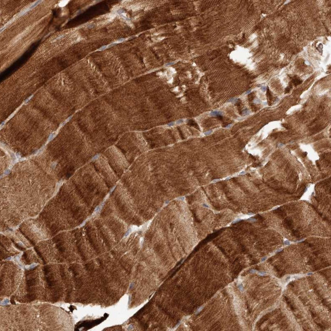 MACF1 Antibody in Immunohistochemistry (Paraffin) (IHC (P))