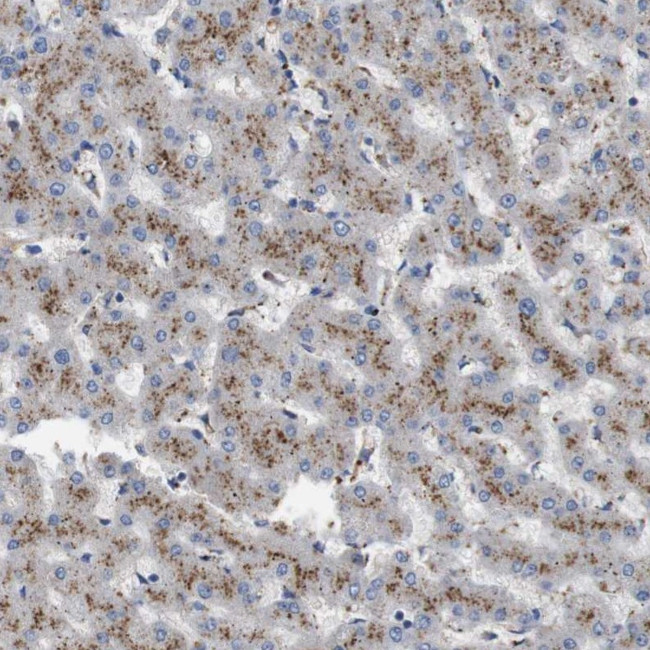 NHLRC3 Antibody in Immunohistochemistry (Paraffin) (IHC (P))