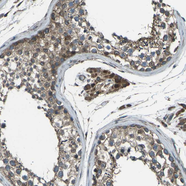 LSMEM1 Antibody in Immunohistochemistry (Paraffin) (IHC (P))