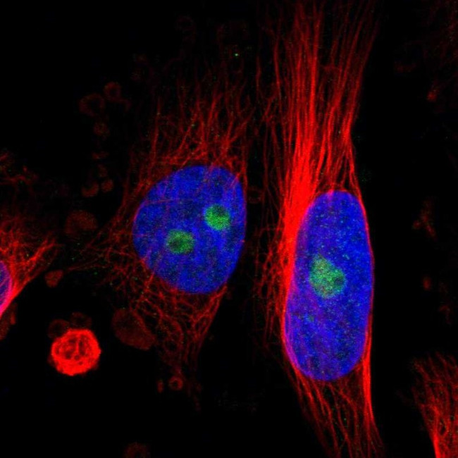 KIAA1551 Antibody in Immunocytochemistry (ICC/IF)