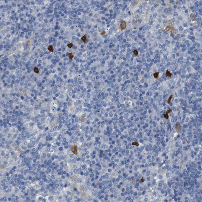 ALOX15 Antibody in Immunohistochemistry (Paraffin) (IHC (P))