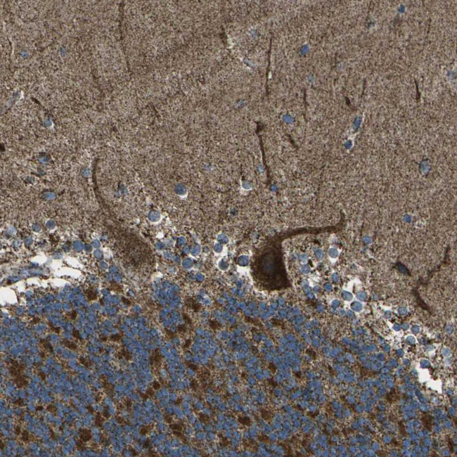 KLHL5 Antibody in Immunohistochemistry (Paraffin) (IHC (P))