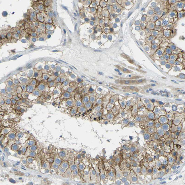 RHBDD1 Antibody in Immunohistochemistry (Paraffin) (IHC (P))