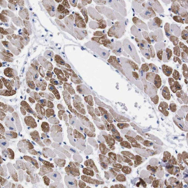 NEBL Antibody in Immunohistochemistry (Paraffin) (IHC (P))