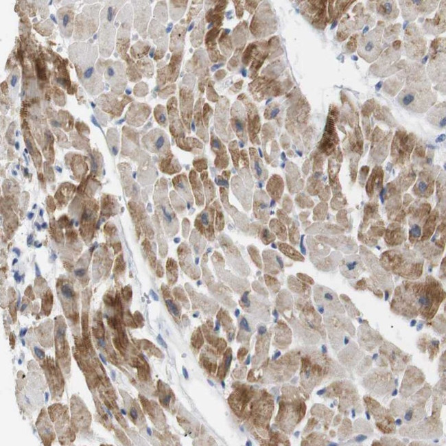 NEBL Antibody in Immunohistochemistry (Paraffin) (IHC (P))