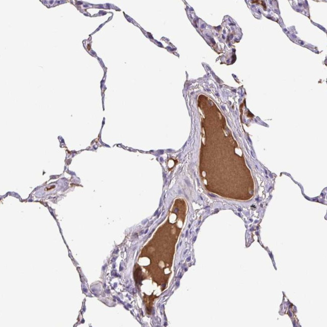IGFL1 Antibody in Immunohistochemistry (Paraffin) (IHC (P))