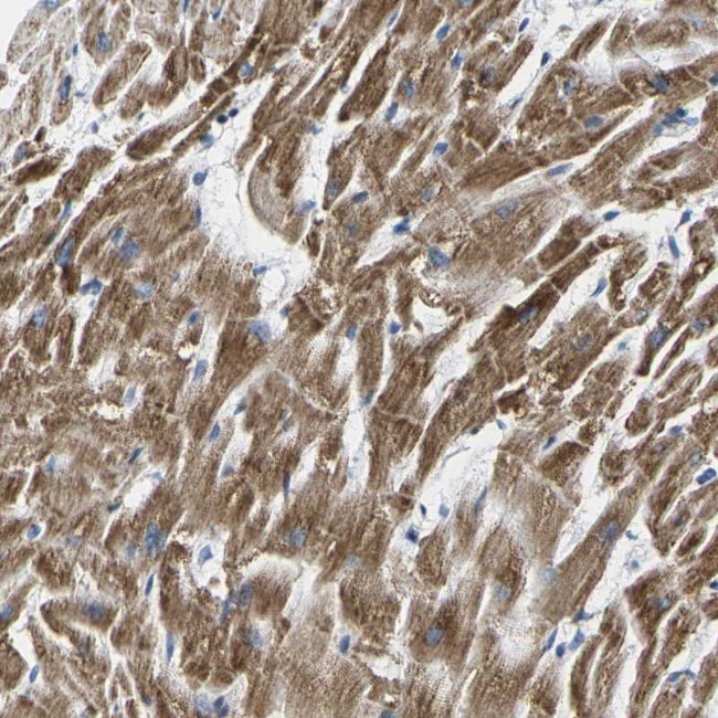 TMEM204 Antibody in Immunohistochemistry (Paraffin) (IHC (P))