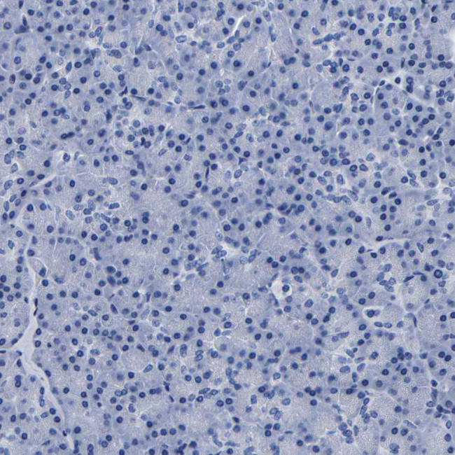 CLEC4G Antibody in Immunohistochemistry (Paraffin) (IHC (P))