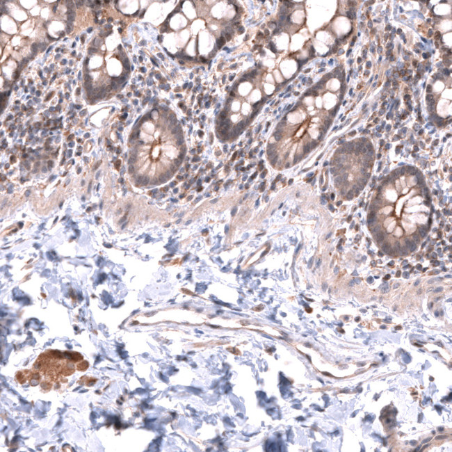 LRRC55 Antibody in Immunohistochemistry (Paraffin) (IHC (P))
