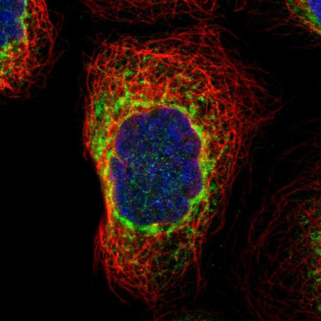 PREB Antibody in Immunocytochemistry (ICC/IF)