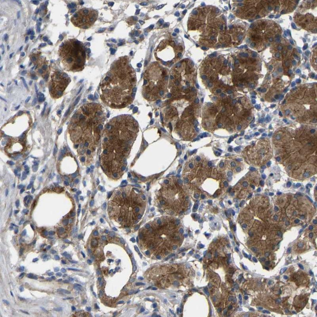 SYPL1 Antibody in Immunohistochemistry (Paraffin) (IHC (P))
