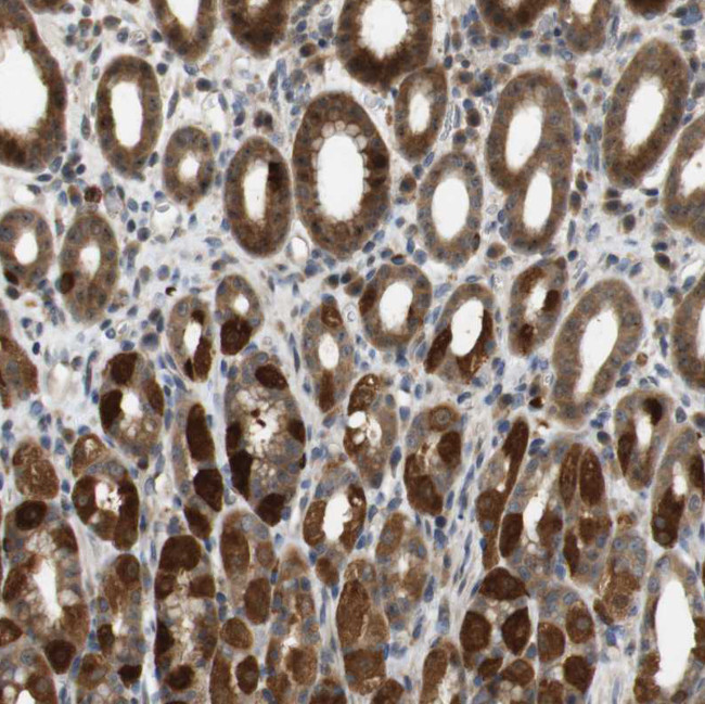 TMX3 Antibody in Immunohistochemistry (Paraffin) (IHC (P))
