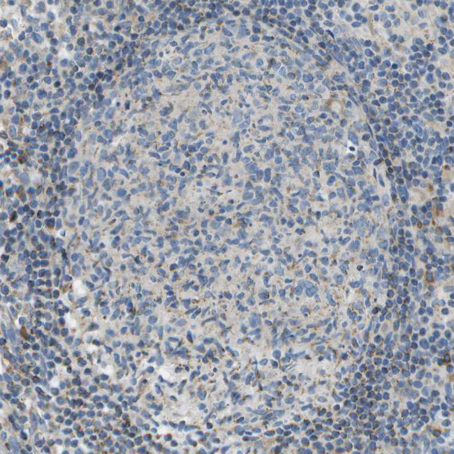 PTGIS Antibody in Immunohistochemistry (Paraffin) (IHC (P))