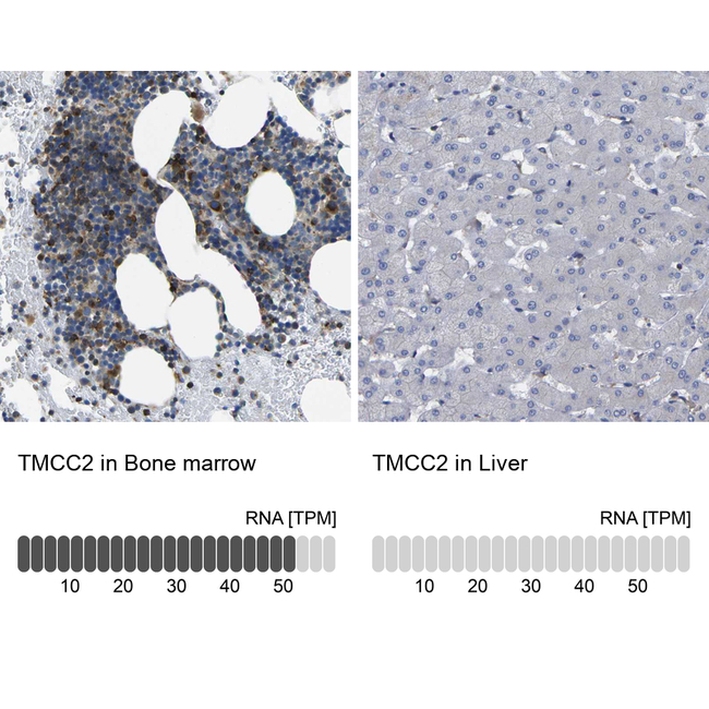 TMCC2 Antibody in Immunohistochemistry (Paraffin) (IHC (P))
