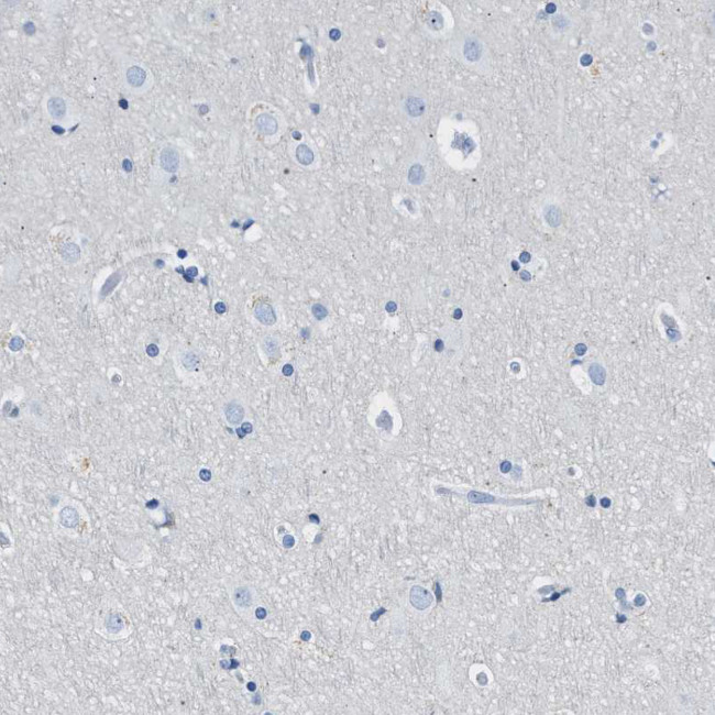 FDCSP Antibody in Immunohistochemistry (Paraffin) (IHC (P))