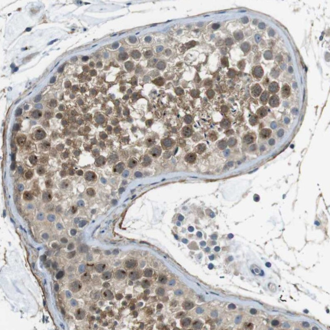 ENTPD7 Antibody in Immunohistochemistry (Paraffin) (IHC (P))