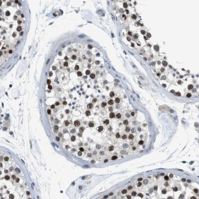 SMCO2 Antibody in Immunohistochemistry (Paraffin) (IHC (P))