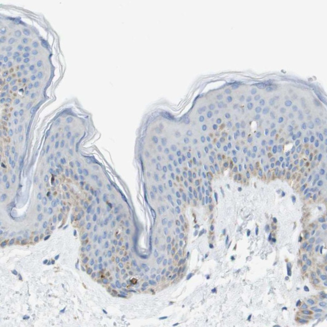 SDR42E1 Antibody in Immunohistochemistry (Paraffin) (IHC (P))