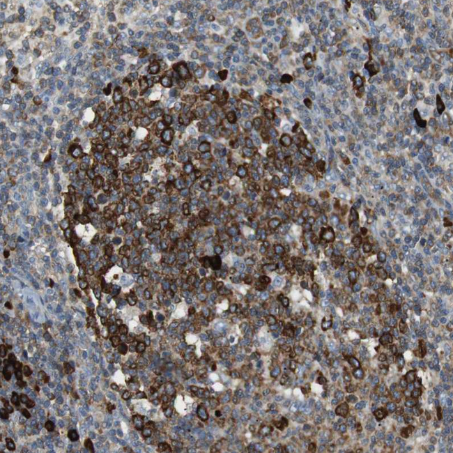 TMEM200A Antibody in Immunohistochemistry (Paraffin) (IHC (P))