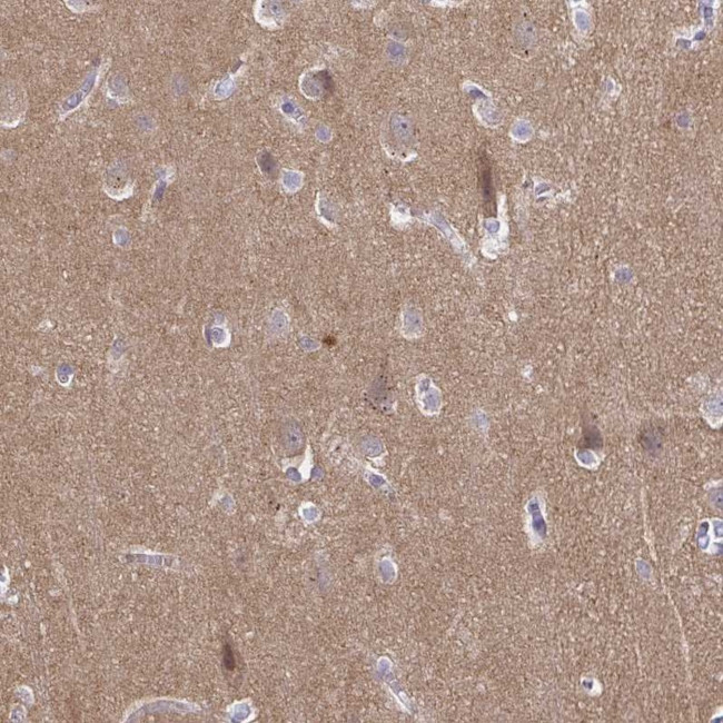 CDH18 Antibody in Immunohistochemistry (Paraffin) (IHC (P))