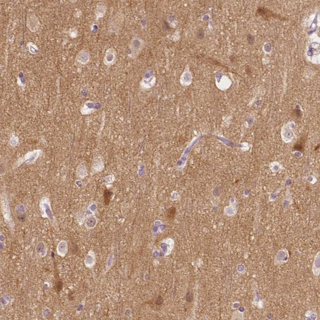 KIAA0513 Antibody in Immunohistochemistry (Paraffin) (IHC (P))
