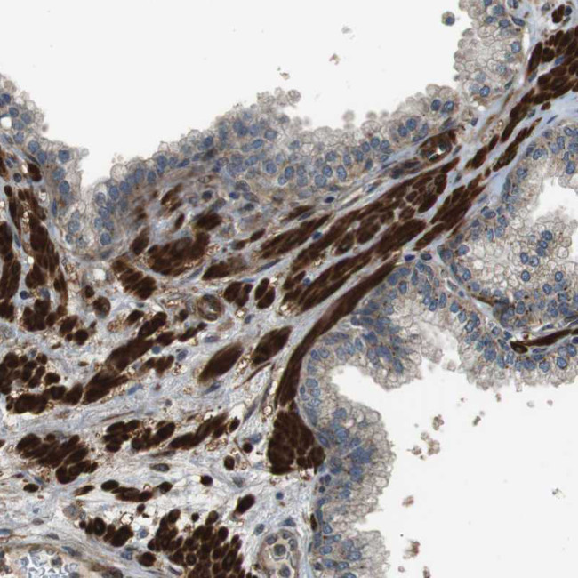 MSRB3 Antibody in Immunohistochemistry (Paraffin) (IHC (P))