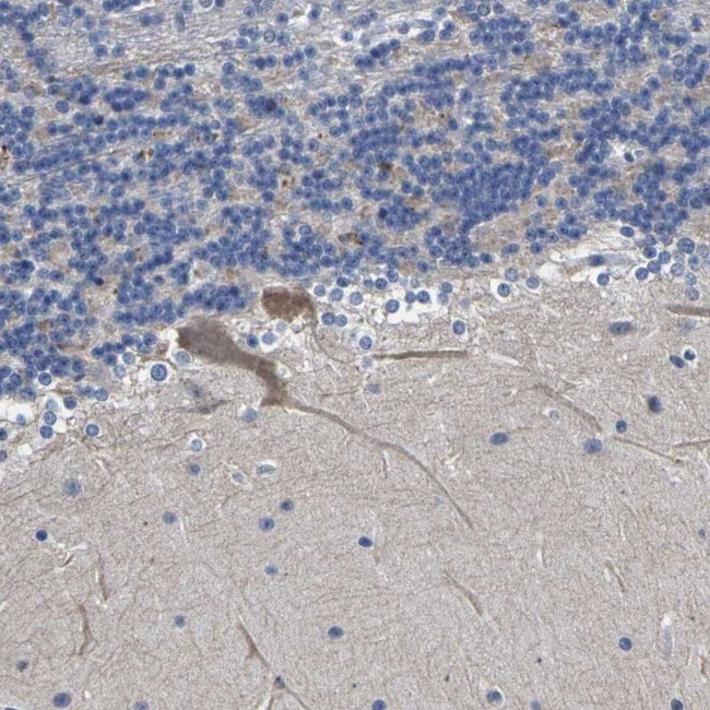 ST6GAL2 Antibody in Immunohistochemistry (IHC)