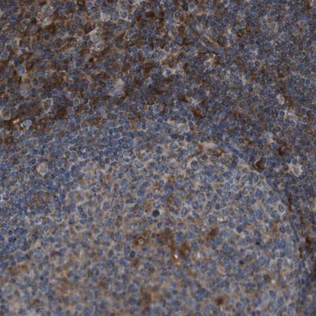 GIMAP8 Antibody in Immunohistochemistry (IHC)