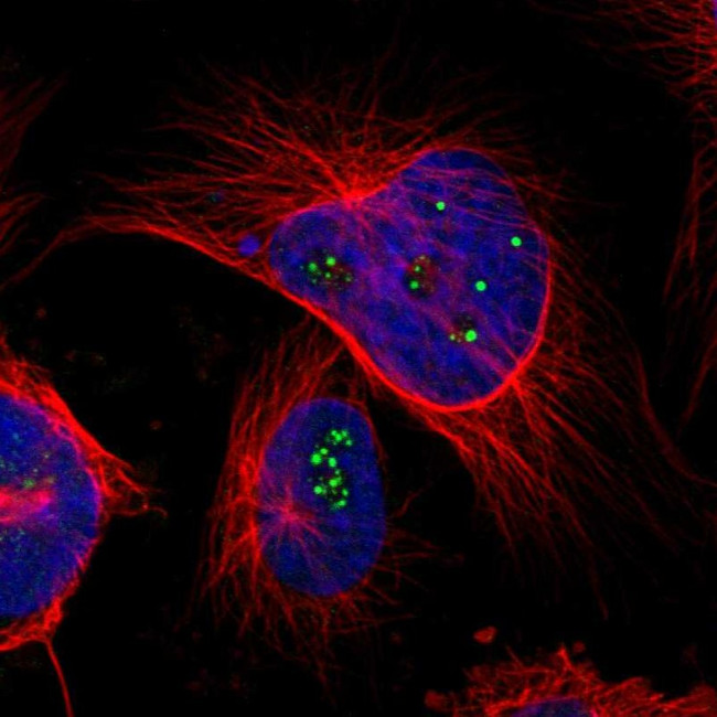 TMEM143 Antibody in Immunocytochemistry (ICC/IF)
