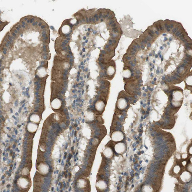 CLRN3 Antibody in Immunohistochemistry (Paraffin) (IHC (P))