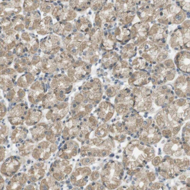 ZDHHC20 Antibody in Immunohistochemistry (IHC)