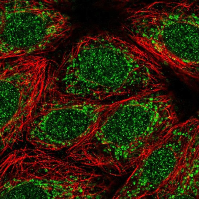 TMEM223 Antibody in Immunocytochemistry (ICC/IF)