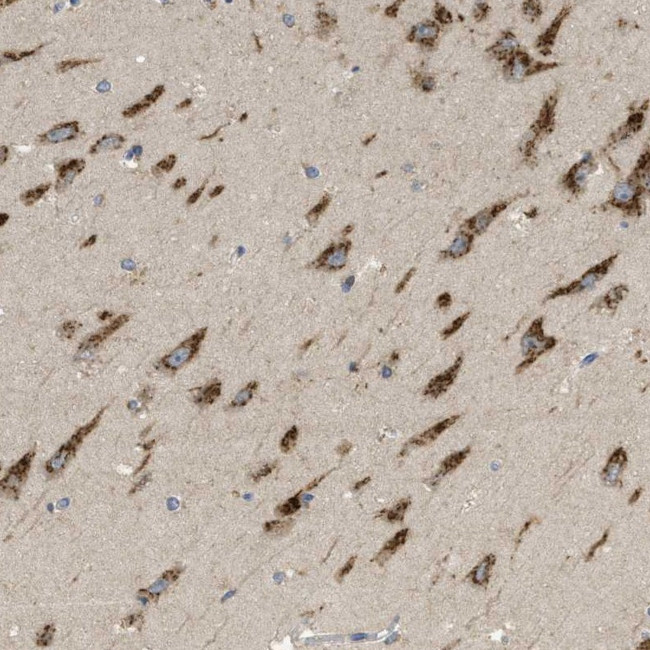 C19orf18 Antibody in Immunohistochemistry (Paraffin) (IHC (P))