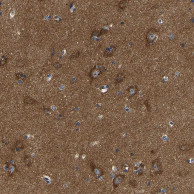 ABCA10 Antibody in Immunohistochemistry (Paraffin) (IHC (P))
