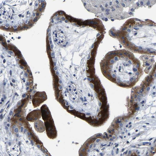 FGD5 Antibody in Immunohistochemistry (Paraffin) (IHC (P))