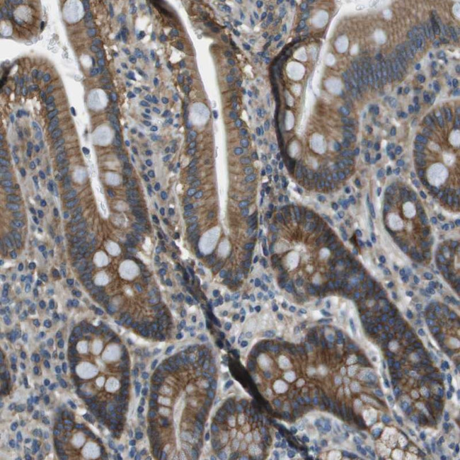 TMEM51 Antibody in Immunohistochemistry (Paraffin) (IHC (P))
