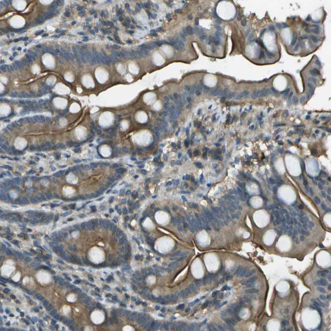 LRRC66 Antibody in Immunohistochemistry (Paraffin) (IHC (P))