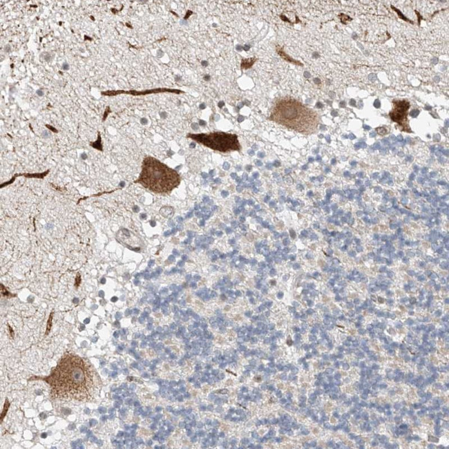 STARD9 Antibody in Immunohistochemistry (Paraffin) (IHC (P))