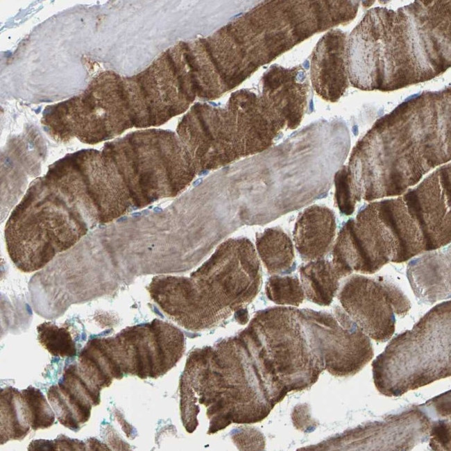 TMCO4 Antibody in Immunohistochemistry (Paraffin) (IHC (P))