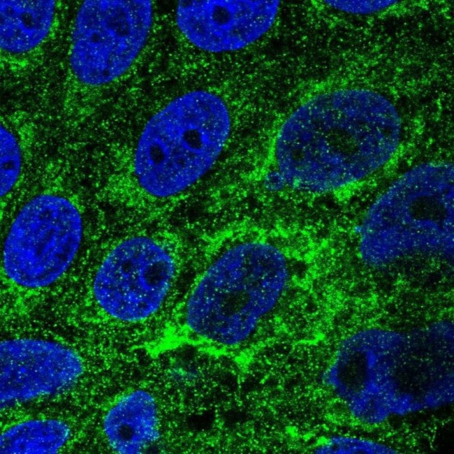 TMEM141 Antibody in Immunocytochemistry (ICC/IF)