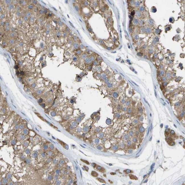 DPM3 Antibody in Immunohistochemistry (Paraffin) (IHC (P))