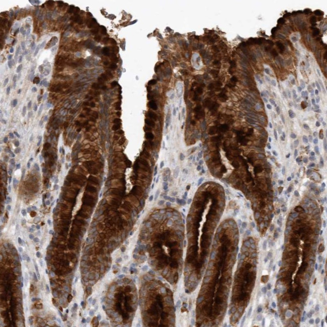 Melanophilin Antibody in Immunohistochemistry (Paraffin) (IHC (P))