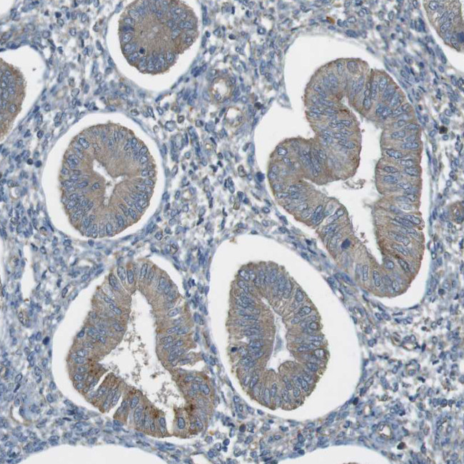 ZDHHC20 Antibody in Immunohistochemistry (Paraffin) (IHC (P))