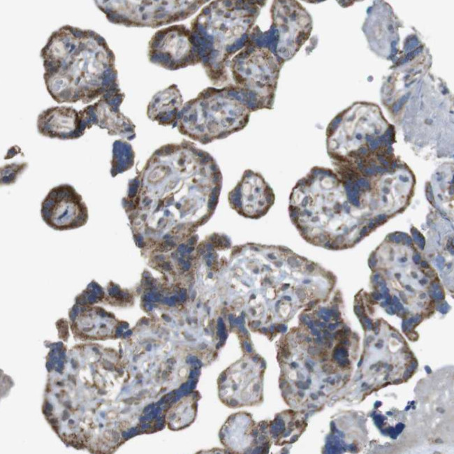 CALHM2 Antibody in Immunohistochemistry (Paraffin) (IHC (P))