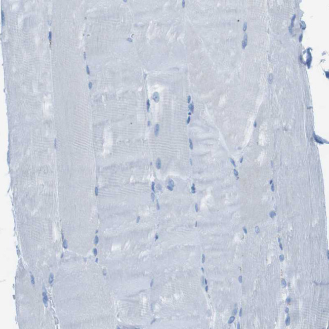 MCEMP1 Antibody in Immunohistochemistry (Paraffin) (IHC (P))