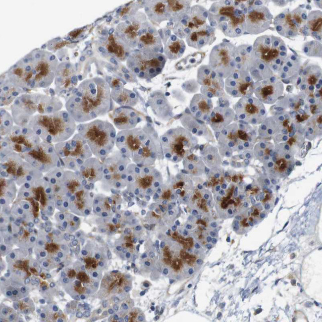 CYB561 Antibody in Immunohistochemistry (Paraffin) (IHC (P))