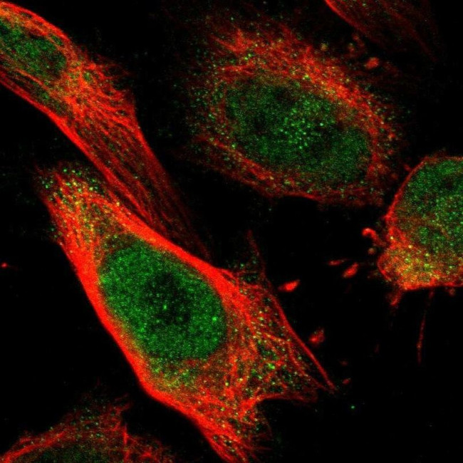DSE Antibody in Immunocytochemistry (ICC/IF)