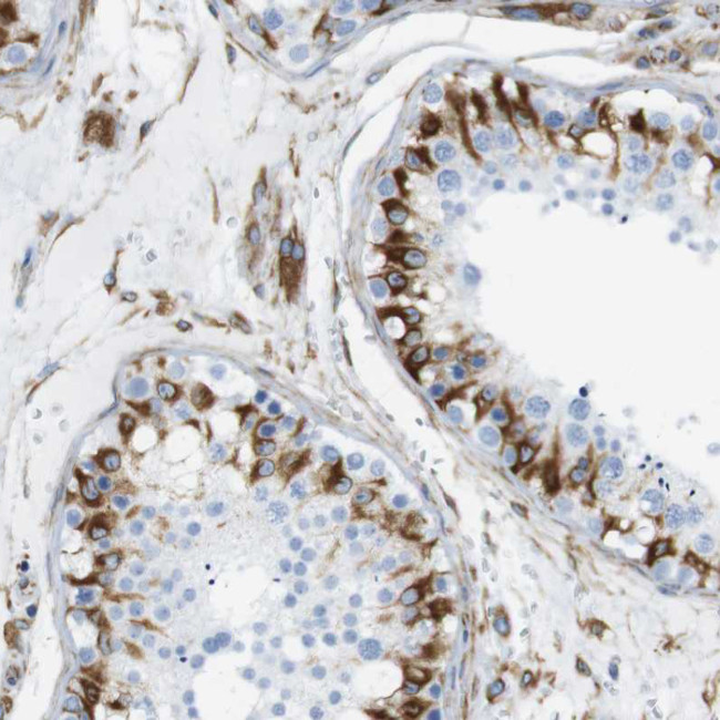 MS4A10 Antibody in Immunohistochemistry (Paraffin) (IHC (P))