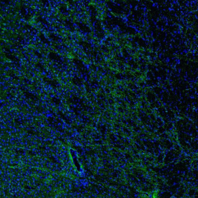 Aquaporin 4 Antibody in Immunocytochemistry (ICC/IF)